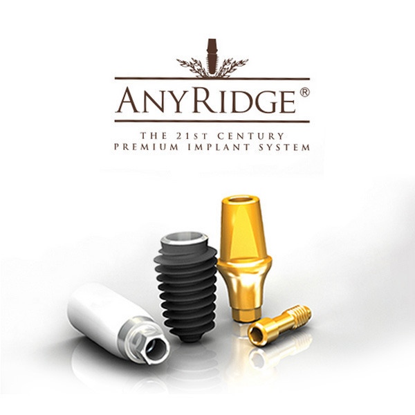 Имплант AnyRidge (Южная Корея)