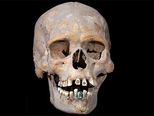 Археологи нашли скелет, которому приблизительно 1600 лет, с каменным протезом зуба